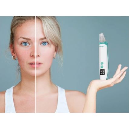 Beper - Ładowalny oczyszczacz porów USB/5V 400 mAh