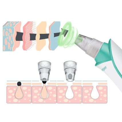 Beper - Ładowalny oczyszczacz porów USB/5V 400 mAh